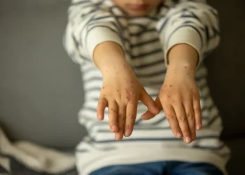 doença, viral, infecção, contágiosa, vírus, sintomas, prevenção;